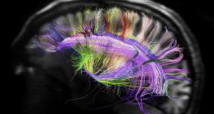 rainbow-brain